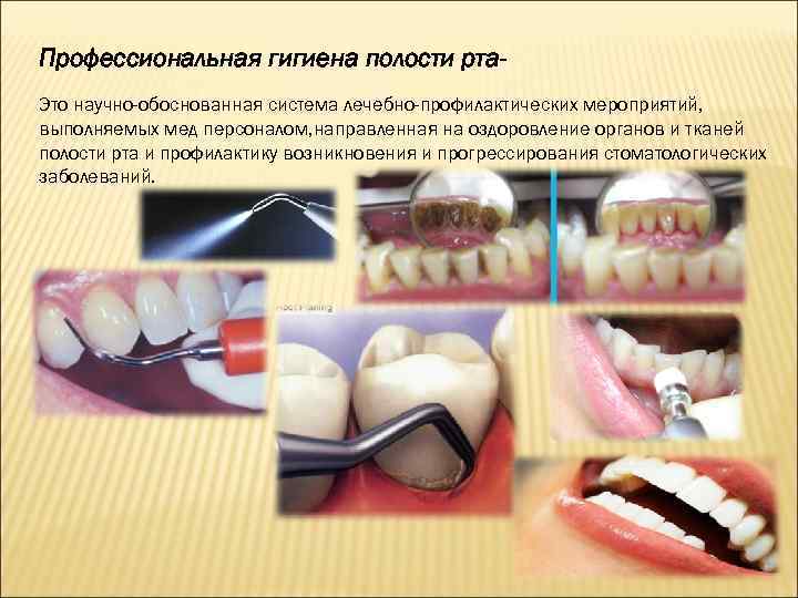 Профессиональная гигиена полости рта презентация